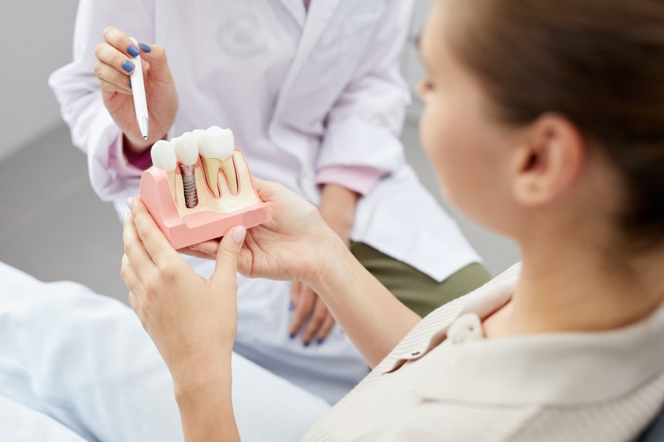 Tooth Implantation Model